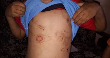 تفاصيل واقعة تعذيب طفلين على يد زوج والدتهما بقليوب