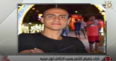 الطالب مارو وحيد عن التنمر على لون عينيه: لم أبالى بآراء الأخرين