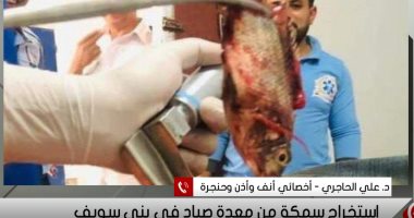 طبيب بنى سويف يكشف كواليس استخراج سمكة حية من فم صياد