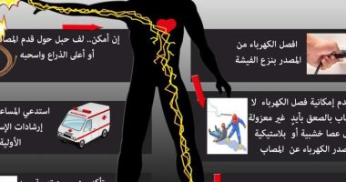 6 معلومات هامة لإسعاف مصاب الصعق الكهربائى.. تعرف عليها