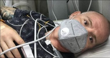 بريطانى يصاب بالعمى والشلل بعد لدغة قاتلة من كوبرا فى الهند 