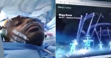 مريض هندى يخضع لجراحة دقيقة في الدماغ أثناء مشاهدته فيلم "أفاتار"