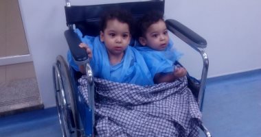 والدة توأم ملتصق بعد فصلهما: زوجى طلقنى بعد رفضى إسقاطهما