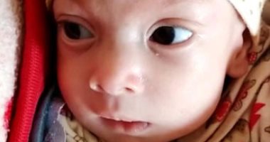 محافظ كفر الشيخ يطمئن على حالة طفل بعد إجرائه لعملية على نفقة الدولة.. فيديو وصور