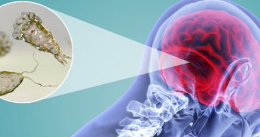 الأميبا الآكلة للدماغ ينتشر بسرعة فى أمريكا.. اعرف كل شىء عن المرض