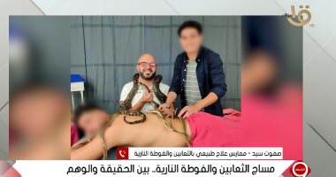لقطة اليوم.. ممارس علاج طبيعى بالثعابين: بيأتى عندنا لاعبين مثل الشحات وقفشة