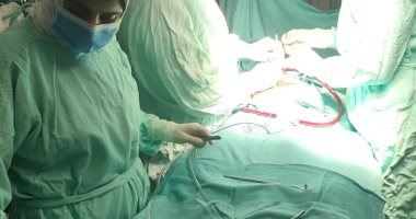 نجاح عملية قلب مفتوح لطفلة تعانى من تشوه خلقى بمستشفى المنصورة الدولى