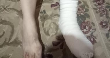 إصابة صاحب معرض سيارات بكسر فى القدم بعد دفاعه عن فتيات من التحرش بالغربية