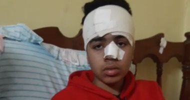 مروان طالب الإعدادية كاد يفقد عينه بسبب دفاعه عن شقيقه بمنشأة القناطر.. فيديو