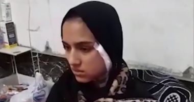 ضحية سائق توك توك تحكى قصة تشويه وجهها بعد رفضها الزواج منه.. فيديو