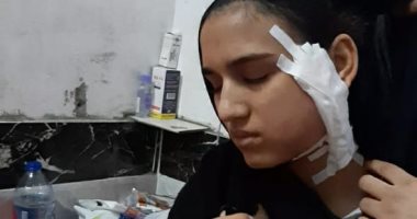 روميو السفاح.. سائق توك توك شوه وجه فتاة رفضت الزواج به بأوسيم.. المتهم طارد الضحية فى الشارع وقطع وجهها بـ"كتر".. المجنى عليها لـ اليوم السابع: قالي يا تكوني ليا يا تعيشي وحيدة.. والدتها تطلب حق ابنتها.. فيديو