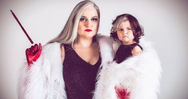  طفلة برازيلية تلفت الأنظار بخصلات بيضاء فى شعرها.. اعرف السبب "صور"