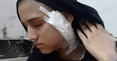 ضحية"روميو السفاح" تقدم تقريرا بإصاباتها للنيابة لعرضها على الطب الشرعى 