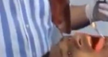 طبيب يزيل سمكة بطول 18 سم من حلق صياد كولومبى.. اعرف القصة