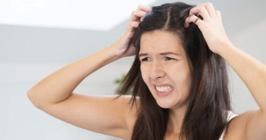 وصفات طبيعية للتخلص من حكة فروة الرأس.. عشان ما تحسيش بالإحراج