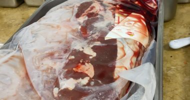 غلق 7 منشآت غذائية مخالفة خلال حملات تفتيشية بالدقهلية