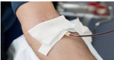 دراسة تدعو إلى استخدام بلازما التعافى من كورونا بحذر لأصحاب الأمراض المزمنة