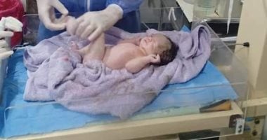 فريق طبى ينجح فى إجراء ولادة قيصرية لسيدة مصابة بكورونا بقنا