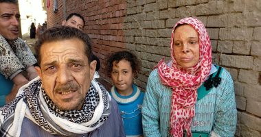 مأساة "سمر".. احترق وجهها على البوتاجاز فتشوهت ملامحها وتنمر عليها زوجها.. صور