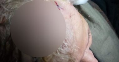 إصابة سيدة مسنة بجروح قطعية بالرأس فى مشاجرة مع جيرانها بطنطا