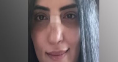حورية فرغلى تكشف لليوم السابع حقيقة صورها المتداولة بعد إجراء عملية جراحية