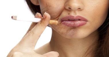 ثقوب ملابسك واصفرار أسنانك وتجاعيد جلدك.. أسباب تجبرك على الإقلاع عن التدخين  