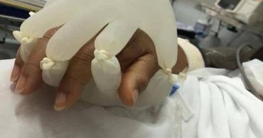 إطلاق مبادرة "القفازات المطاطية بالماء الساخن" لدعم مرضى كورونا فى البرازيل