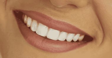 وصفات طبيعية للتخلص من جير الأسنان.. ابتسمى وانتى واثقة فى نفسك