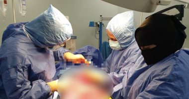 أطباء مستشفى الغردقة العام ينجحون في إجراء عملية قيصرية لمصابة بكورونا وتلد توأم