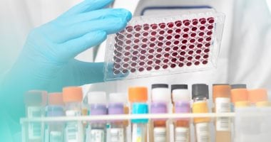 حالات تستدعى إجراء تحليل الميوجلوبين.. منها النوبة القلبية
