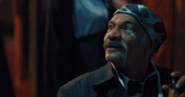 لا للتنمر.. كيف تعامل صناع الدراما مع مرض البهاق؟.. فيديو