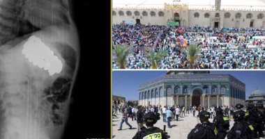التليفزيون هذا المساء.. الأوقاف: يجوز للمسلم صلاة العيد بالمنزل إذا خشى التزاحم.. مصر تطالب إسرائيل بوقف الاعتداءات على الأراضى الفلسطينية.. استخراج 30 صامولة من معدة طفلة فى تغطية خاصة لتليفزيون اليوم السابع