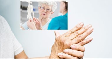 6 أطعمة تدعم صحة عظامك.. منها الأفوكادو وزيت الزيتون