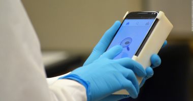 جوجل تطور برنامجا جديدا يتيح تشخيص 288 مرضًا جلديًا بكاميرا الهاتف