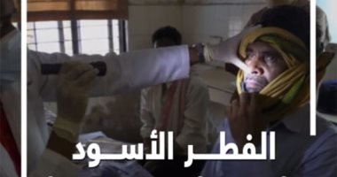 الصحة تكشف بروتوكول علاج الفطر الأسود وتحذر من التأخر فى العلاج  
