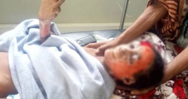 تليجراف: حروق مروعة تشير لاحتمال استخدام الفسفور الأبيض فى تيجراى بإثيوبيا
