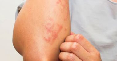 أخطاء فى غسل وتجفيف الملابس تؤثر على البشرة وصحة الجلد