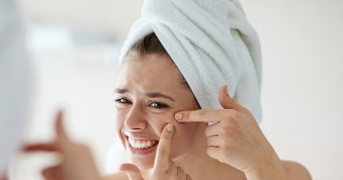 وصفات طبيعية لعلاج حب الشباب.. من جل الصبار للعسل