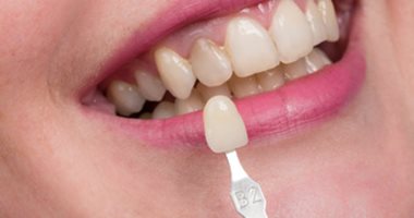 نصائح للحفاظ على غطاء أسنانك منها عدم مضغ الثلج  