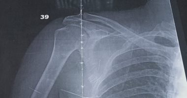 قارئ يناشد مستشفى جامعة الزقازيق سرعة إجراء عملية جراحية.. والجامعة تستجيب