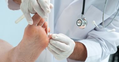 طرق الوقاية من قرح القدم الناتجة عن مرض السكرى