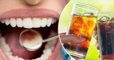 تعرف على التأثيرات الصحية لمشروبات الصودا.. منها انخفاض كثافة العظام