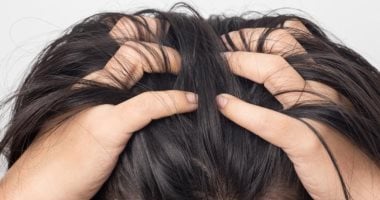 نصائح للعناية بالشعر.. اعرفى أفضل الطرق لعلاج حكة فروة الرأس "الكركديه الأبرز"