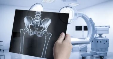 نخر العظام مضاعفات جديدة لكورونا بعد الفطر الأسود تظهر بالهند.. اعرف كل شيء عنه 