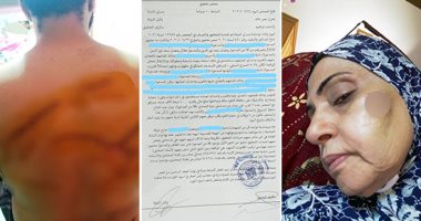 "خريطة على ظهر مهندس".. الجيران مزقوا جسد "هلال" على خلفية تركيب كاميرات مراقبة.. الأم تروى تفاصيل المشاجرة: جارتى التهمت وجهى وابنى دافع عنى "فشرحوه" بالأسلحة البيضاء.. والنيابة تحقق في الواقعة.. صور