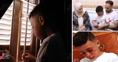 طفل القمر عايش فى الضلمة ومحروم من الشمس.. عمرو مصاب بمرض جلدى حرمه من الحياة.. والدته: الدكتور قالى ابنك عنده مرض سيدنا أيوب ومش هيعيش وبعدها الدكتور توفى.. وتناشد: بيتنمروا عليه ونفسى دكتور يتكفل بحالته