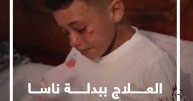 العلاج ببدلة ناسا.. استغاثة أم لابنها المصاب بمرض طفل القمر النادر.. فيديو