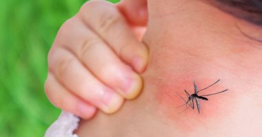 5 أمراض شائعة عند الأطفال بموسم الصيف..اعرفى ازاى تتغلبى عليها 
