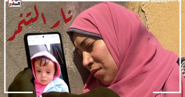 نار التنمر .. سخروا من حروق جسدها ومتلازمة داون لبنتها المتوفية