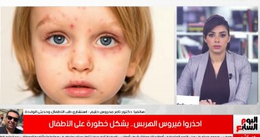 فيروس الهربس خطر على الأطفال ويجب علاجه سريعا حتى لا يؤثر على حياتهم